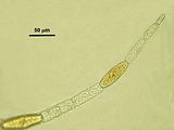 Dettaglio delle cellule con tannini e della cellula apicale mucronata